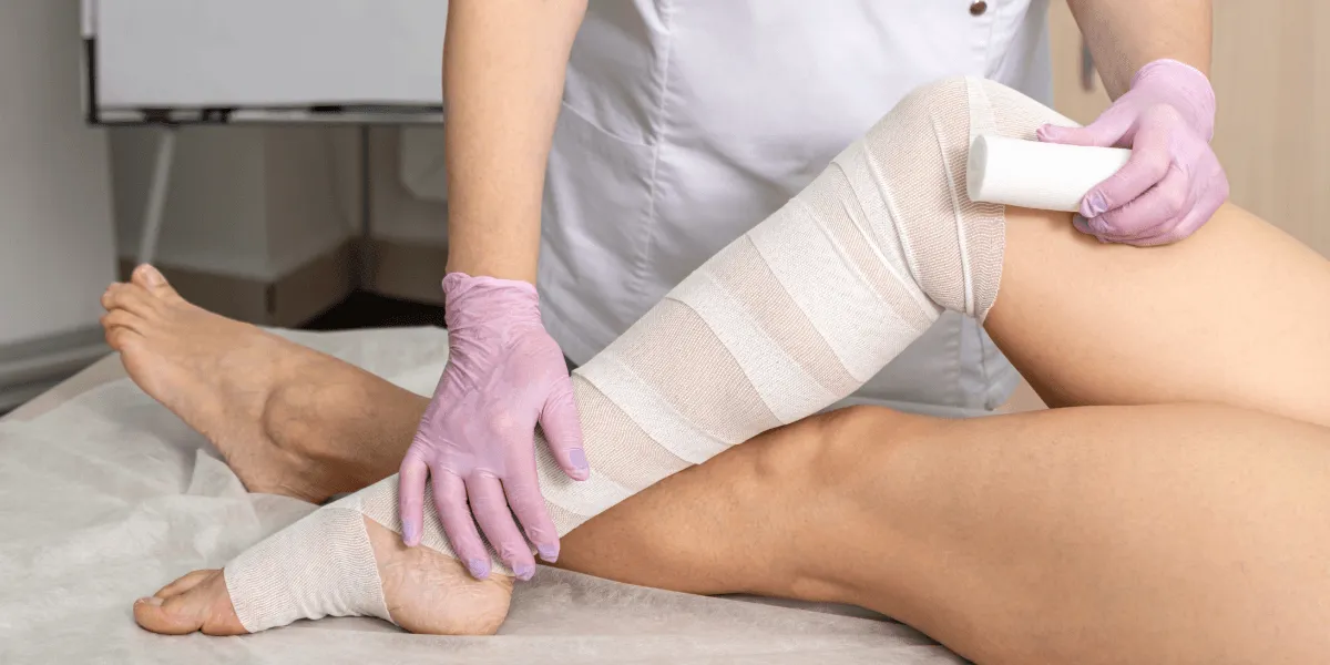 Liposuktion Lipödem: Wickelverband am Unterschenkel und Fuß wird von einer Pflegekraft angelegt.
