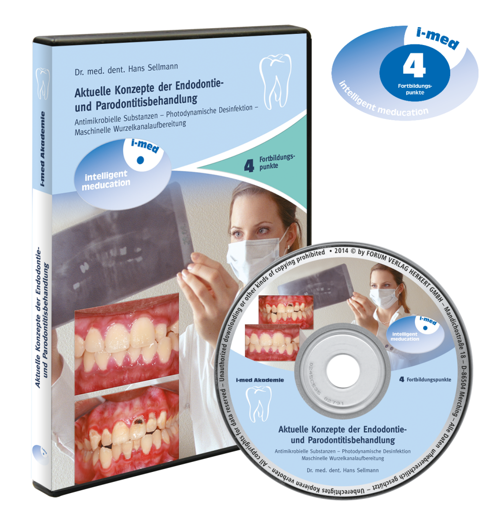 DVD 43 Aktuelle Konzepte der Endodontie- und Paradontitisbehandlung