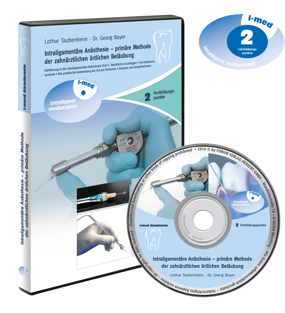 DVD 67 Intraligamentäre Anästhesie